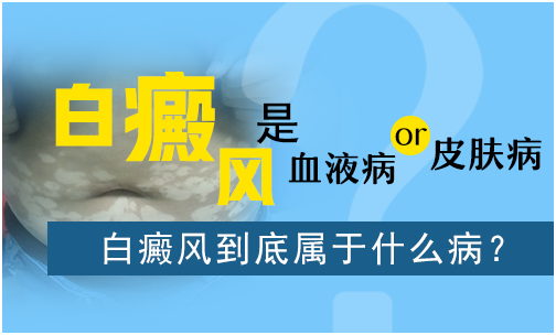 白癜风患者缓解心理压力的方式