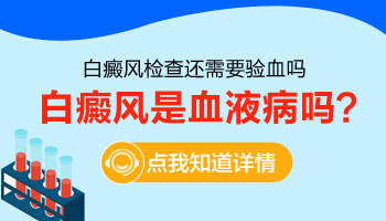 白斑查血液能否确定是不是白癜风