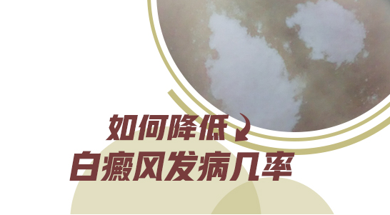 白癜风刚开始有什么症状图片